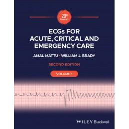 ECGs for Acute, Critical...