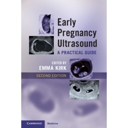 Early Pregnancy Ultrasound: A Practical Guide