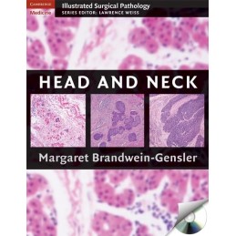 Head and Neck. Illustrated...