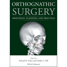 Orthognathic Surgery:...