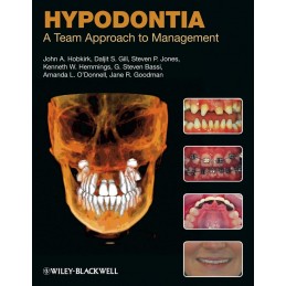 Hypodontia: A Team Approach...