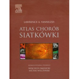 Atlas chorób siatkówki