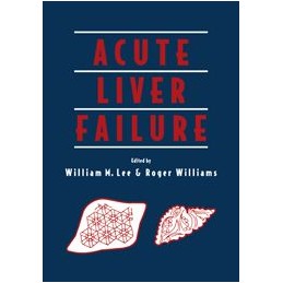 Acute Liver Failure