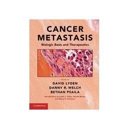Cancer Metastasis: Biologic...