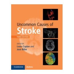 Uncommon Causes of Stroke