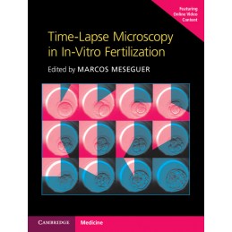 Time-Lapse Microscopy in...