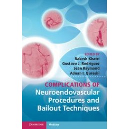 Complications of...