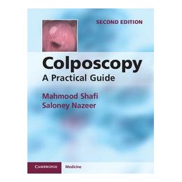 Colposcopy: A Practical Guide