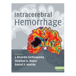 Intracerebral Hemorrhage