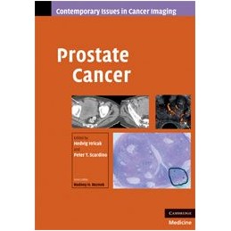 Prostate Cancer