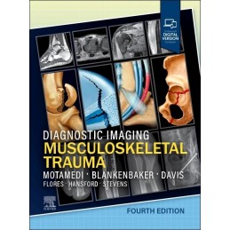 Diagnostic Imaging: Musculoskeletal Trauma