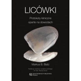 Licówki