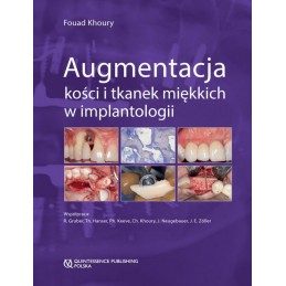 Augmentacja kości i tkanek...