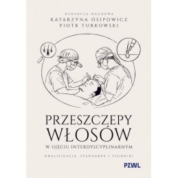 Przeszczepy włosów w ujęciu...