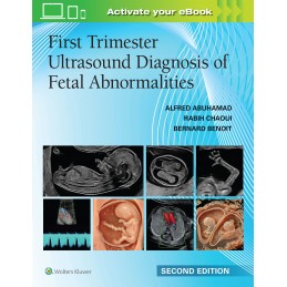First Trimester Ultrasound...