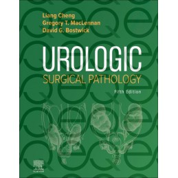Urologic Surgical Pathology