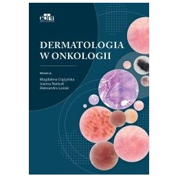 Dermatologia w onkologii