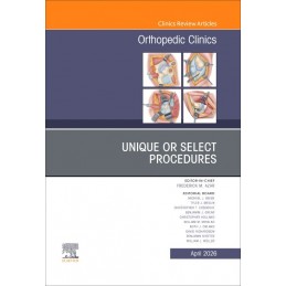 Unique or Select...