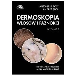 Dermoskopia skóry głowy i...