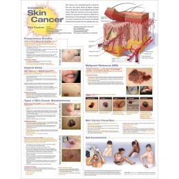 Understanding Skin Cancer...
