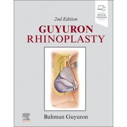 Guyuron Rhinoplasty