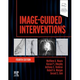 Image-Guided Interventions