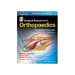 Surgical Exposures in...