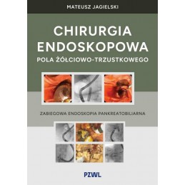 Chirurgia endoskopowa pola...