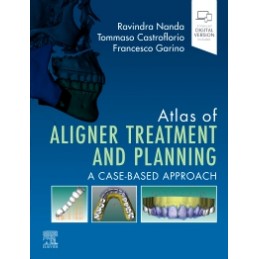 Atlas of Aligner Treatment and Planning