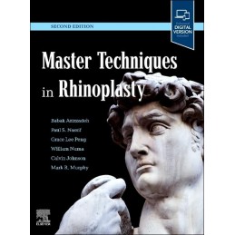 Master Techniques in Rhinoplasty