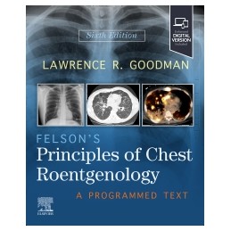 Felson's Principles of Chest Roentgenology