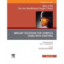 Implant Solutions for...