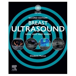 Breast Ultrasound