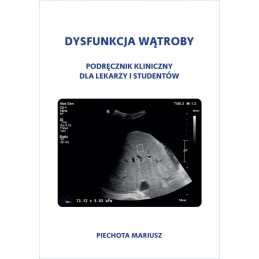Dysfunkcja wątroby