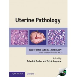 Uterine Pathology