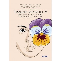 Trądzik pospolity....