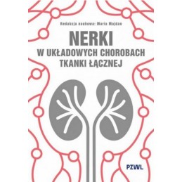 Nerki w układowych...