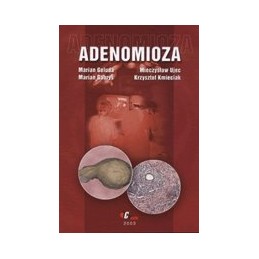 Adenomioza