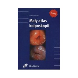 Mały atlas kolposkopii - książka elektroniczna na CD-ROM