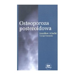 Osteoporoza posteroidowa