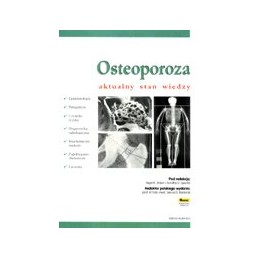 Osteoporoza. Aktualny stan wiedzy