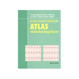 Ostre zespoły wieńcowe - atlas elektrokardiograficzny