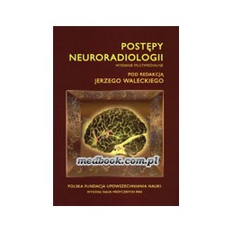 Postępy neuroradiologii