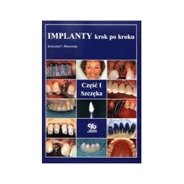 Implanty krok po kroku cz. 1 - szczęka (wydanie na płycie CD)