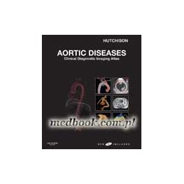 Aortic Diseases