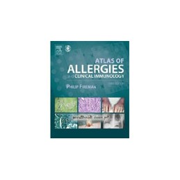 Atlas of Allergies and Clinical Immunology