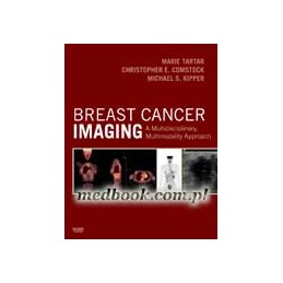 Breast Cancer Imaging