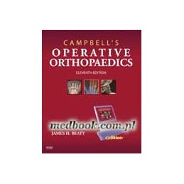 Campbell's Operative Orthopaedics e-dition