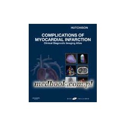 Complications of Myocardial...
