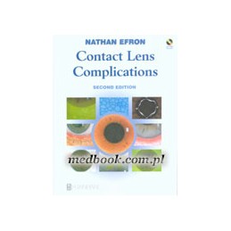 Contact Lens Complications